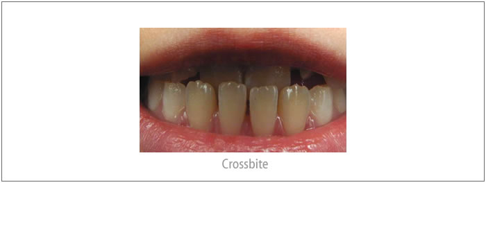 A Time-Critical Orthodontic Problem!